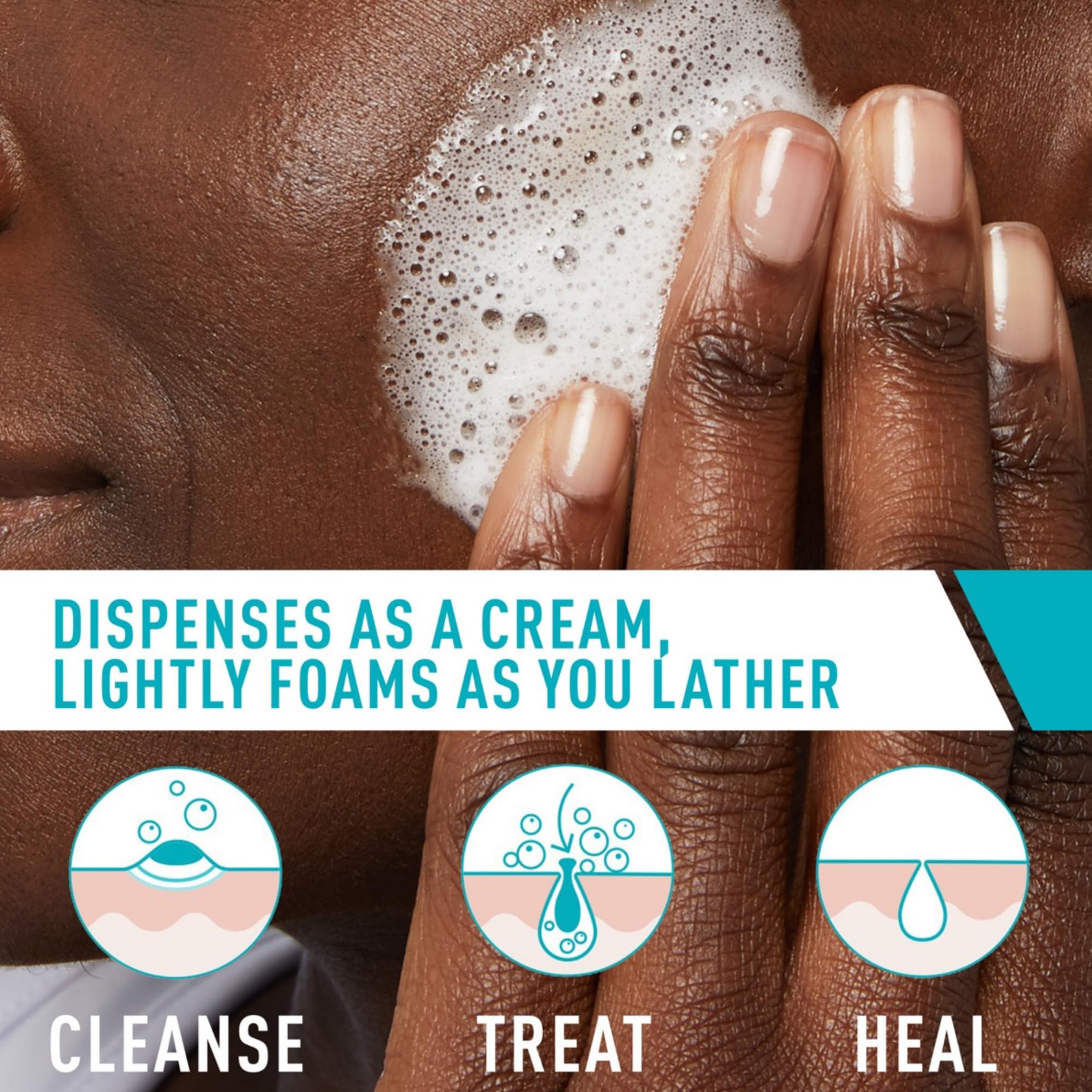 CeraVe Acne Foaming Cream Cleanser 5 fl.oz - Face Wash with 4% Benzoyl Peroxide Helps Clear Acne & Blackheads 3