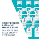 CeraVe Resurfacing Retinol Serum For Post Acne Marks, Formulated With Licorice Root Extract & Niacinamide, Brightening Serum & Pore Minimizer For Face, Post Acne Skin Barrier Repair, Non-Comedogenic 2