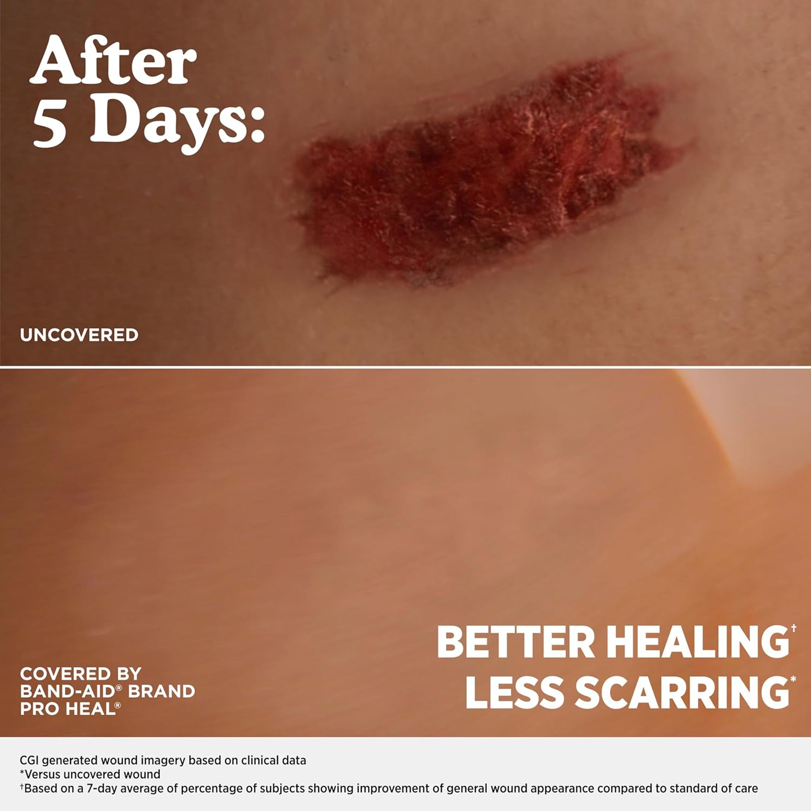 Band-Aid Pro Heal Adhesive Bandages 5 Day Protect, Blister, 6 Count - Waterproof, Extra Cushion for Blister Protection 6