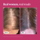 Viviscal Hair Growth Supplement 60 Tablets - for Thicker & Fuller Hair, Nourishes Thinning & Loss 5
