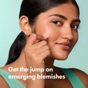 Mighty Patch Hero Cosmetics for Early-Stage Blemishes 8 Count - Micropoint Acne Pimple Patch 2