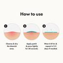 Mighty Patch Hero Cosmetics for Early-Stage Blemishes 8 Count - Micropoint Acne Pimple Patch 5
