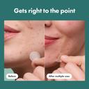 Mighty Patch Hero Cosmetics for Early-Stage Blemishes 8 Count - Micropoint Acne Pimple Patch 6