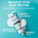 CeraVe Acne Clay To Foam Cleanser 4 fl.oz - Helps Clears Acne & Prevent New Breakouts 2