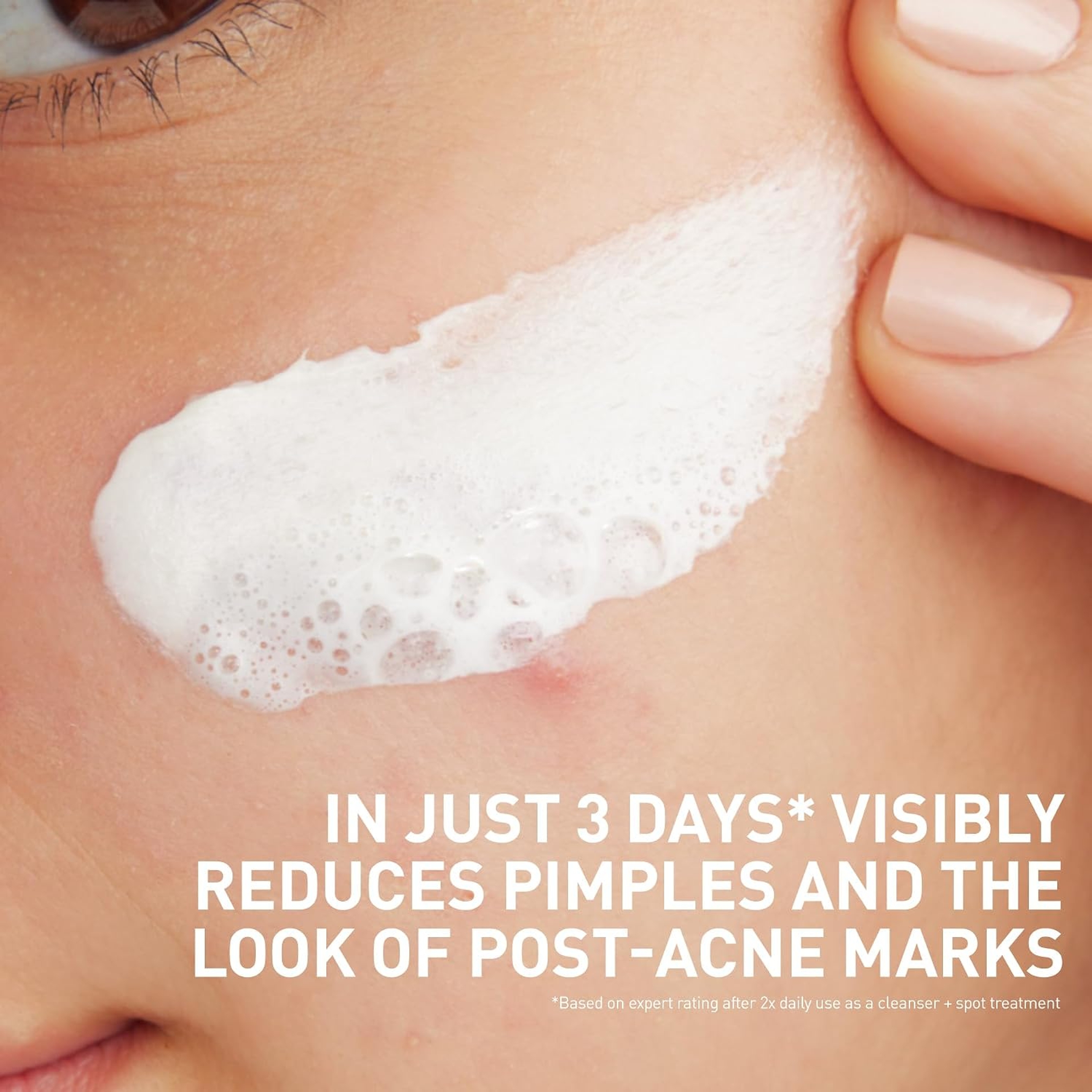 CeraVe Acne Clay To Foam Cleanser 4 fl.oz - Helps Clears Acne & Prevent New Breakouts 3