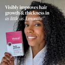 Viviscal Hair Growth Supplement 180 Tablets - for Thicker & Fuller Hair, Nourishes Thinning & Loss 4
