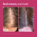 Viviscal Hair Growth Supplement 180 Tablets - for Thicker & Fuller Hair, Nourishes Thinning & Loss 6