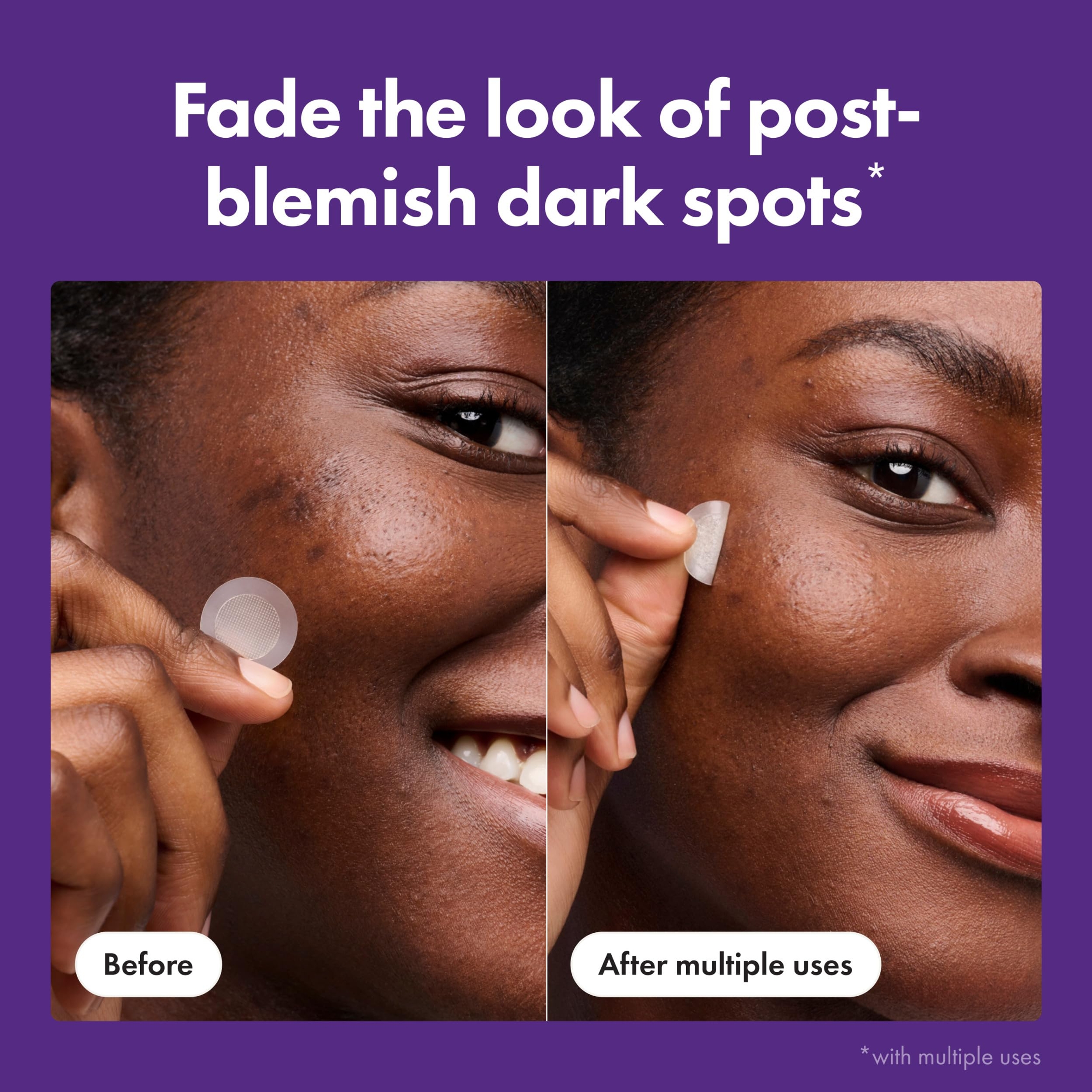 Mighty Patch Hero Cosmetics for Dark Spots 8 Count - Micropoints Post-Blemish Patch with Vitamin C & Niacinamide 3