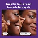 Mighty Patch Hero Cosmetics for Dark Spots 8 Count - Micropoints Post-Blemish Patch with Vitamin C & Niacinamide 3
