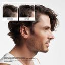 Nioxin System 2 Shampoo 10.1 fl.oz - Cleanse & Boost Density for Natural Hair with Progressed Thinning 2