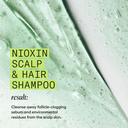 Nioxin System 2 Shampoo 10.1 fl.oz - Cleanse & Boost Density for Natural Hair with Progressed Thinning 9