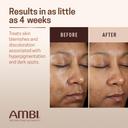 Ambi Even & Clear Advanced Fade Cream 1 fl.oz - Hydroquinone-Free, Stubborn Dark Spot Corrector 4