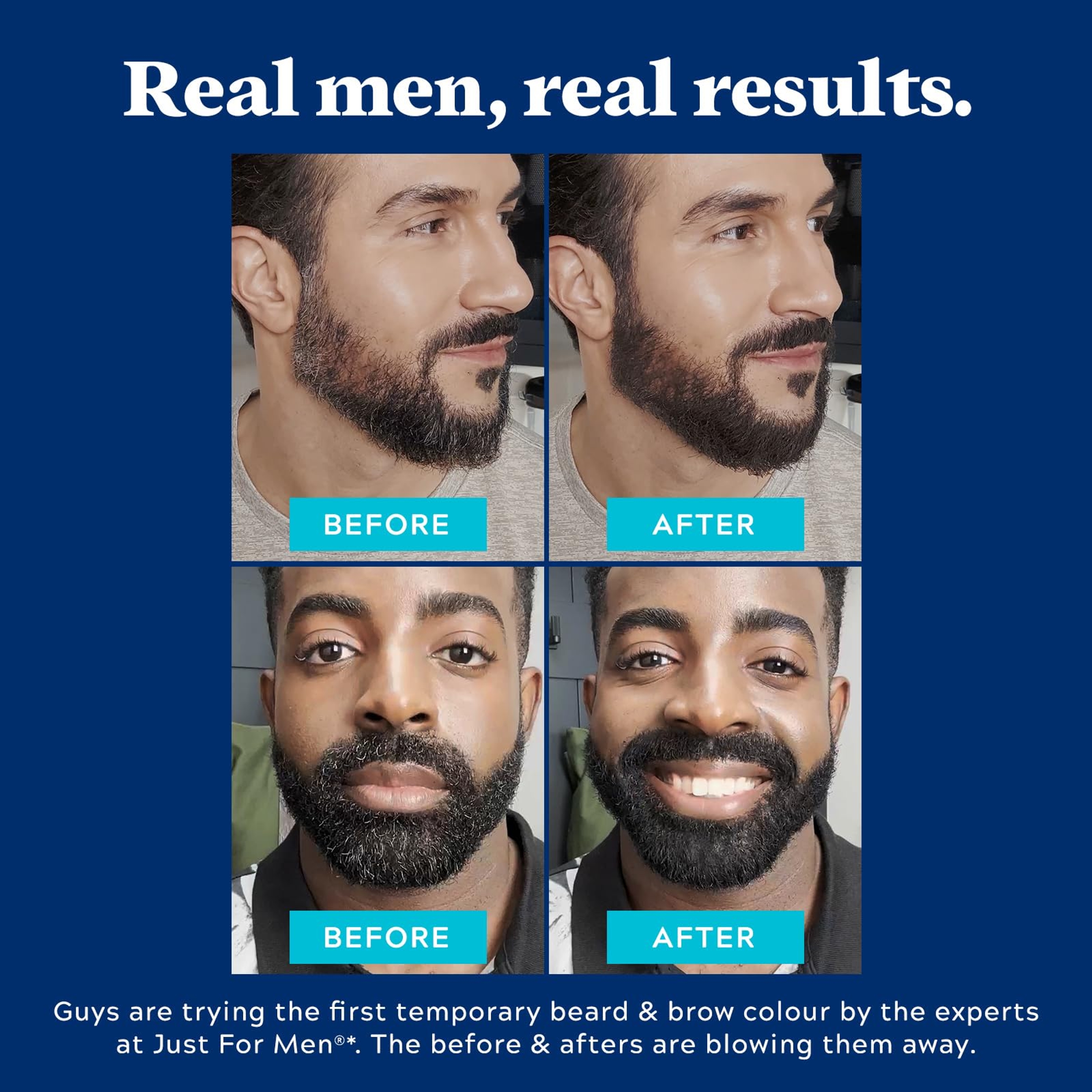 Just For Men 1-Day Beard & Brow Color, Black, 0.3 oz - Temporarily Covers Grays, Fills-In Patchy Areas 5