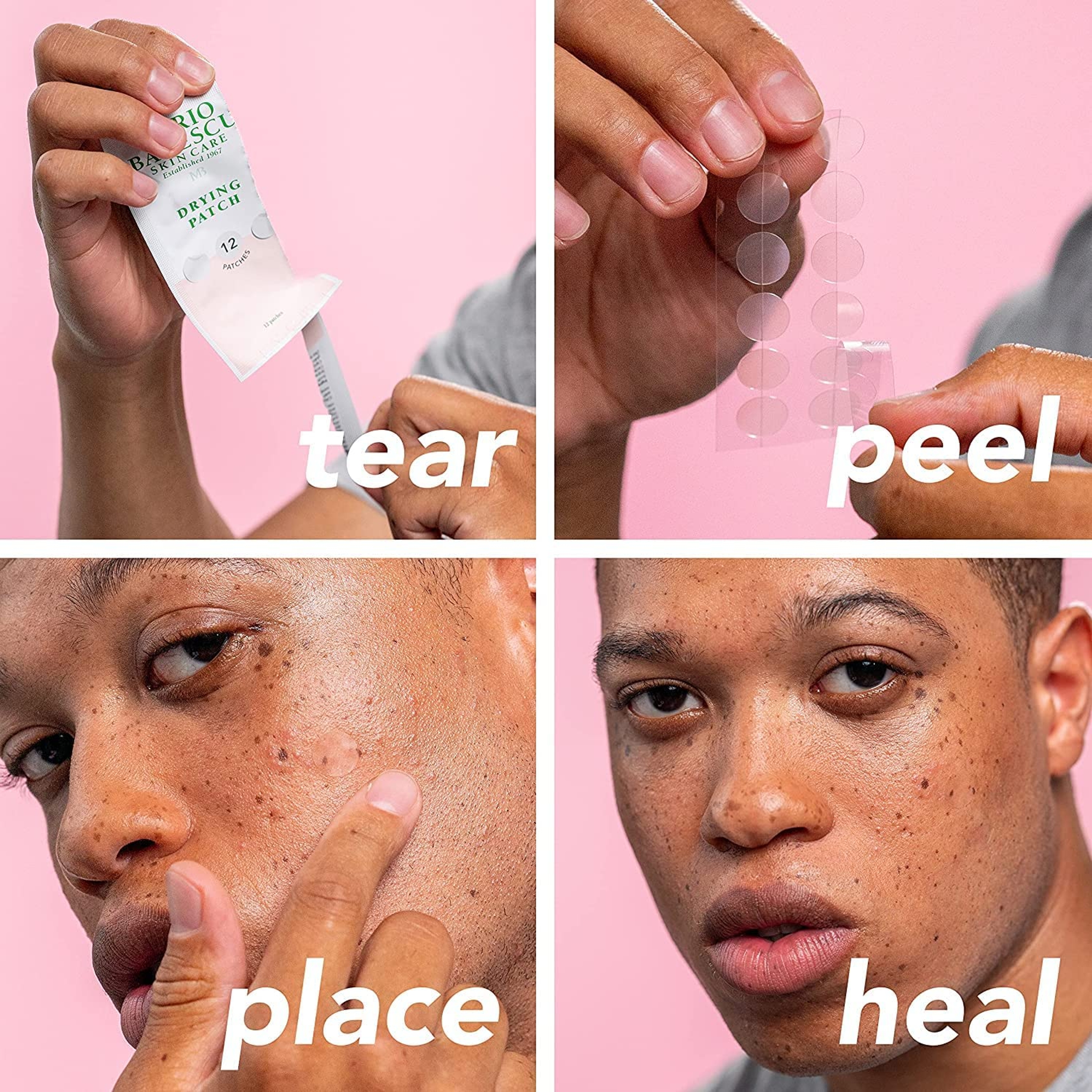 Mario Badescu The Anti Blemish Drying Duo - Drying Lotion Glass Bottle 1 fl.oz & Drying Patch 60 Patches 9