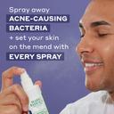Mario Badescu Repairing Facial Spray with Hypochlorous Acid 4 fl.oz - Soothes & Hydrates Irritated Skin, Reduces Redness 2