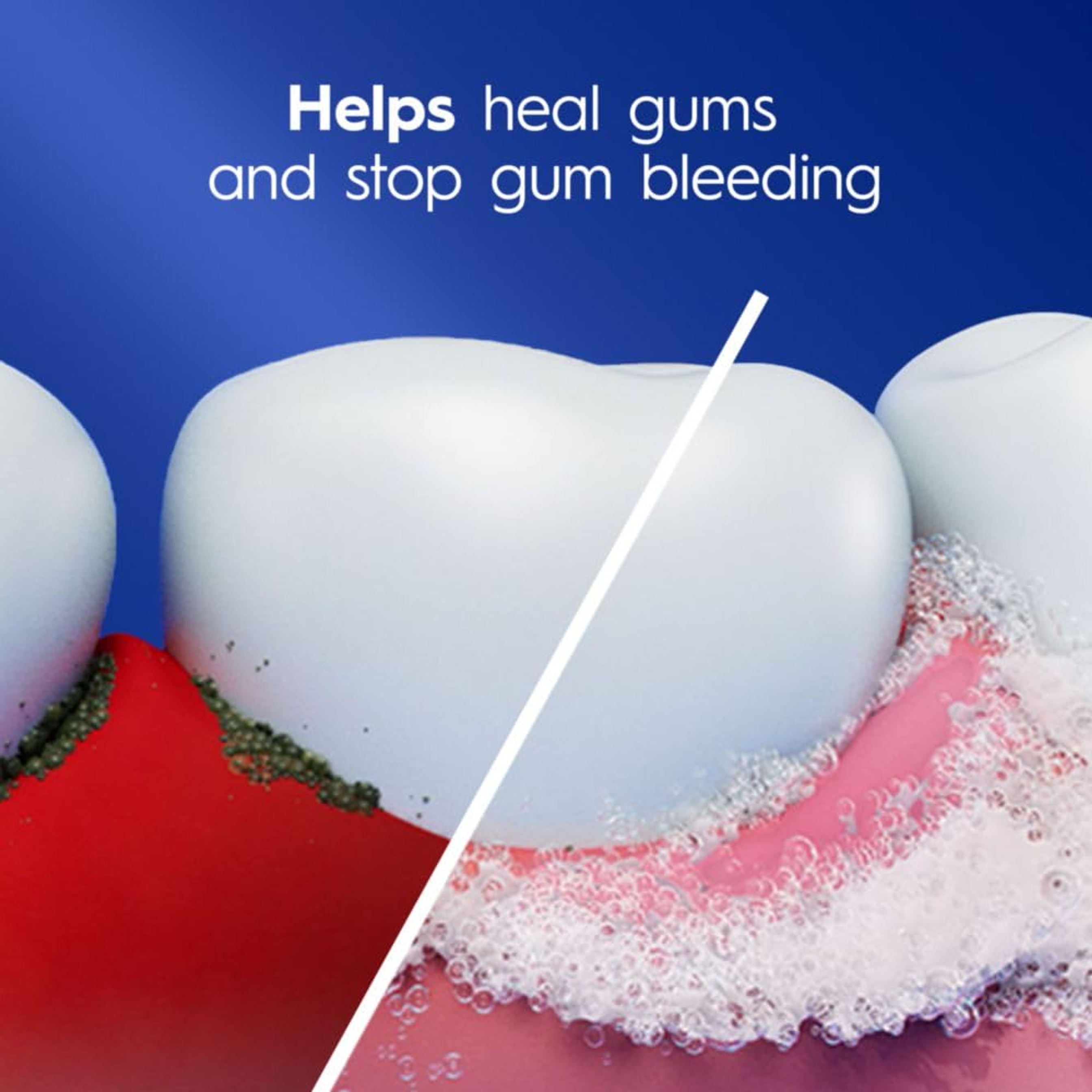 Crest Pro-Health Gum Detoxify Toothpaste 4.8 oz (Pack of 3) - Enamel & Gum Repair, Cavity Protection 4