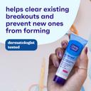 Clean & Clear Persa-Gel 10 Acne Spot Treatment 1 oz - Oil-Free, 10% Benzoyl Peroxide Visibly Reduces Acne in One Day 5