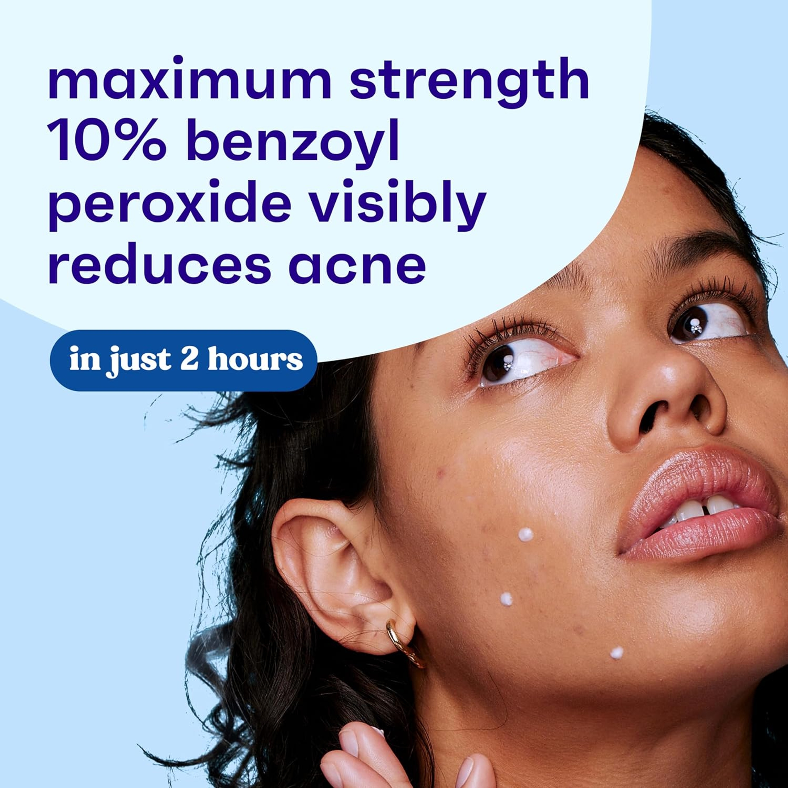Clean & Clear Persa-Gel 10 Acne Spot Treatment 1 oz - Oil-Free, 10% Benzoyl Peroxide Visibly Reduces Acne in One Day 3