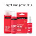 Neutrogena Stubborn Body Acne Cleanser & Exfoliator 8.5 fl.oz - Gently Clears, Exfoliates & Helps Prevent Breakouts 8