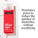 Neutrogena Stubborn Body Acne Cleanser & Exfoliator 8.5 fl.oz - Gently Clears, Exfoliates & Helps Prevent Breakouts 6